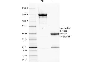 SDS-PAGE Analysis Purified EGFR Mouse Monoclonal Antibody (GFR1195). (EGFR anticorps  (Extracellular Domain))