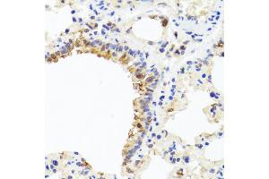 Immunohistochemistry of paraffin-embedded rat lung using CXCL8 antibody (ABIN6290535) at dilution of 1:100 (40x lens).