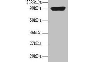 Western blot All lanes: CXCL5 antibody at 2 μg/mL + 293T whole cell lysate Secondary Goat polyclonal to rabbit IgG at 1/15000 dilution Predicted band size: 12 kDa Observed band size: 90 kDa (CXCL5 anticorps  (AA 37-110))