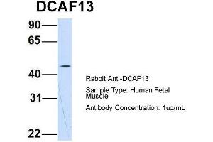 Host: Rabbit  Target Name: DCAF13  Sample Tissue: Human Fetal Muscle  Antibody Dilution: 1. (DCAF13 anticorps  (N-Term))