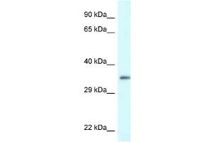 WB Suggested Anti-PDLIM1 Antibody Titration: 1. (PDLIM1 anticorps  (C-Term))