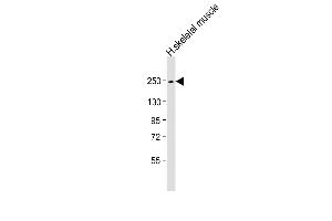 Anti-MYH4 Antibody (N-Term) at 1:1000 dilution + human skeletal muscle lysate Lysates/proteins at 20 μg per lane. (MYH4 anticorps  (AA 346-380))