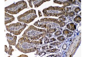 IHC analysis of MED9 using anti-MED9 antibody .