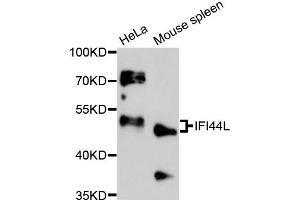 Western blot analysis of extracts of various cell lines, using IFI44L antibody (ABIN6292158) at 1:3000 dilution.
