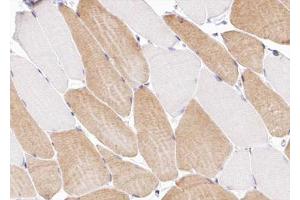 ABIN6266991 at 1/100 staining human Skeletal muscle tissue sections by IHC-P. (COL12A1 anticorps  (Internal Region))