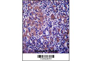 B4GALNT3 Antibody immunohistochemistry analysis in formalin fixed and paraffin embedded human stomach tissue followed by peroxidase conjugation of the secondary antibody and DAB staining. (B4GALNT3 anticorps  (AA 555-584))