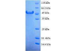 SDS-PAGE (SDS) image for Hyaluronan Binding Protein 2 (HABP2) (AA 37-313), (partial) protein (His-SUMO Tag) (ABIN5711269)