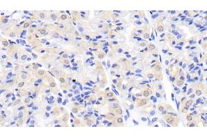 Detection of CK-BB in Human Stomach Tissue using Monoclonal Antibody to Creatine Kinase B (CK-BB)