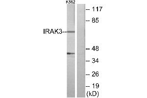 Immunohistochemistry analysis of paraffin-embedded human brain tissue using IRAK3 antibody. (IRAK3 anticorps)