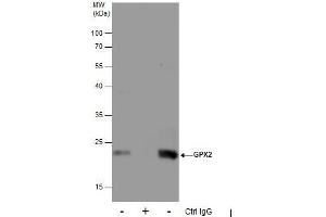 IP Image Immunoprecipitation of GPX2 protein from HepG2 whole cell extracts using 5 μg of GPX2 antibody [C1C3], Western blot analysis was performed using GPX2 antibody [C1C3], EasyBlot anti-Rabbit IgG  was used as a secondary reagent. (Glutathione Peroxidase 2 anticorps  (C-Term))