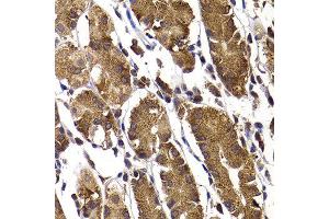 Immunohistochemistry of paraffin-embedded human stomach using STAMBP antibody at dilution of 1:100 (x400 lens). (STAMBP anticorps)