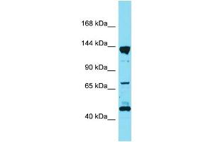 Western Blotting (WB) image for anti-Liprin alpha 3 (PPFIA3) (C-Term) antibody (ABIN2791058) (LIPA3 anticorps  (C-Term))