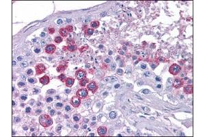 Human Testis: Formalin-Fixed, Paraffin-Embedded (FFPE)