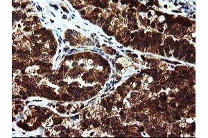 Image no. 4 for anti-Mannose Phosphate Isomerase (MPI) antibody (ABIN1499543)