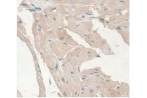 IHC-P analysis of Rat Heart Tissue, with DAB staining. (Androgen Receptor anticorps  (AA 491-679))
