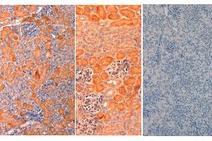 Immunohistochemistry of Rabbit anti-mouse DELTA1 Antibody in Mouse Embryonic Kidney Tissue: Mouse Embryonic Kidney Fixation: FFPE buffered formalin 10% conc Ag Retrieval: Heat, Citrate pH 6. (DLL1 anticorps  (AA 155-173))
