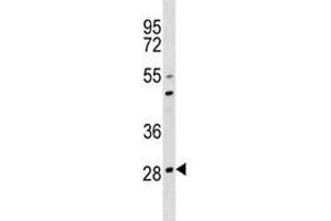 OSCAR antibody western blot analysis in 293 lysate.