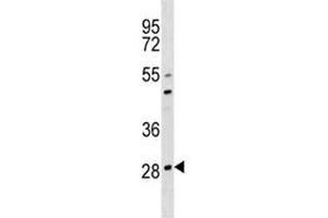 OSCAR antibody western blot analysis in 293 lysate. (OSCAR anticorps  (AA 205-231))