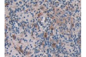 Detection of FTMT in Mouse Spleen Tissue using Polyclonal Antibody to Ferritin, Mitochondrial (FTMT)