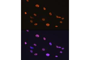 Immunofluorescence analysis of C6 cells using TDP-43/TARDB Rabbit mAb (ABIN7270730) at dilution of 1:100 (40x lens). (TARDBP anticorps)