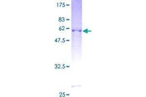 Image no. 1 for BTG Family, Member 3 (BTG3) (AA 1-296) protein (GST tag) (ABIN1346953)
