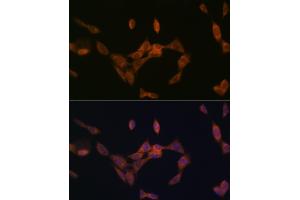 Immunofluorescence analysis of NIH-3T3 cells using PMP70/ Rabbit mAb (ABIN1683181, ABIN3018647, ABIN3018648 and ABIN7101638) at dilution of 1:100 (40x lens).