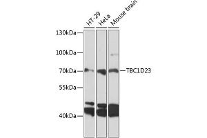 Western blot analysis of extracts of various cell lines, using TBC1D23 antibody (ABIN6133202, ABIN6148882, ABIN6148883 and ABIN6224939) at 1:3000 dilution. (TBC1D23 anticorps  (AA 250-600))