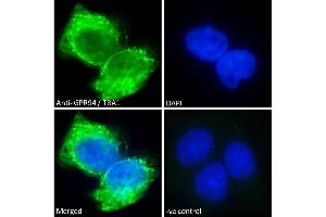ABIN185655 Immunofluorescence analysis of paraformaldehyde fixed A431 cells, permeabilized with 0.
