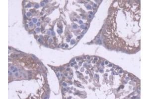 Detection of ALDH1A1 in Mouse Testis Tissue using Polyclonal Antibody to Aldehyde Dehydrogenase 1 Family, Member A1 (ALDH1A1)