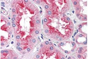 Human Kidney (formalin-fixed, paraffin-embedded) stained with SMAD9 antibody ABIN337365 at 5 ug/ml followed by biotinylated anti-goat IgG secondary antibody ABIN481715, alkaline phosphatase-streptavidin and chromogen. (SMAD9 anticorps  (AA 166-179))