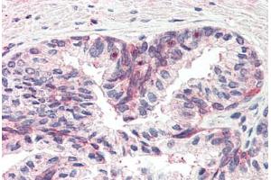 Human Prostate (formalin-fixed, paraffin-embedded) stained with MSX1 antibody ABIN337116 at 2. (MSX1 anticorps  (AA 8-19))