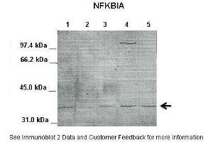 Lanes:   1. (NFKBIA anticorps  (Middle Region))