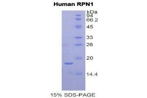 SDS-PAGE (SDS) image for Ribophorin 1 (RPN1) (AA 308-438) protein (His tag) (ABIN2122025) (RPN1 Protein (AA 308-438) (His tag))