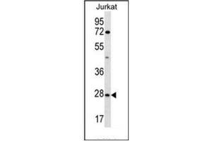 Western blot analysis of OR6T1 Antibody (C-term) in Jurkat cell line lysates (35ug/lane). (OR6T1 anticorps  (C-Term))
