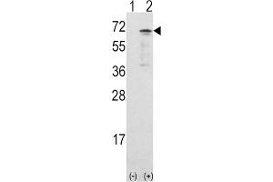 Western Blotting (WB) image for anti-Calcium/calmodulin-Dependent Protein Kinase Kinase 1, alpha (CAMKK1) antibody (ABIN3003480) (CAMKK1 anticorps)