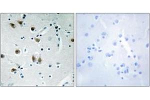 Immunohistochemistry analysis of paraffin-embedded human brain tissue, using ZNF148 Antibody.