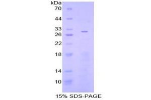 SDS-PAGE analysis of Human Adenylate Cyclase 3 Protein. (ADCY3 Protéine)