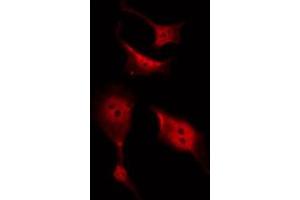 ABIN6267480 staining SW626 by IF/ICC. (CTNNB1 anticorps  (pTyr489))
