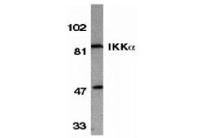 Western Blotting (WB) image for anti-conserved Helix-Loop-Helix Ubiquitous Kinase (CHUK) antibody (ABIN1030202) (IKK alpha anticorps)
