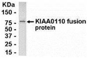 Western Blotting (WB) image for anti-MAD2L1 Binding Protein (MAD2L1BP) (AA 1-126) antibody (ABIN2468117) (MAD2L1BP anticorps  (AA 1-126))