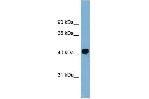 WB Suggested Anti-KIAA1704 Antibody Titration: 0. (GPALPP1 anticorps  (Middle Region))