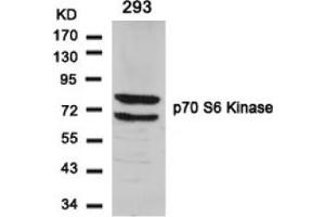 Image no. 3 for anti-Ribosomal Protein S6 Kinase, 70kDa, Polypeptide 1 (RPS6KB1) (Ser424) antibody (ABIN197549) (RPS6KB1 anticorps  (Ser424))