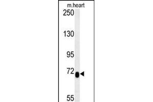 LCA5L Antibody (C-term) (ABIN653975 and ABIN2843921) western blot analysis in mouse heart tissue lysates (15 μg/lane). (LCA5L anticorps  (C-Term))