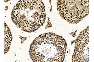 ABIN7095488 and ABIN7099545 at 1/100 staining mouse testis tissue by IHC-P. (UBXN7 anticorps)