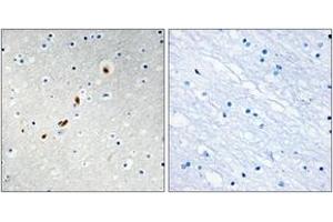 Immunohistochemistry analysis of paraffin-embedded human brain tissue, using ZNF596 Antibody. (ZNF596 anticorps  (AA 261-310))