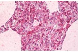 Anti-ABCB7 antibody IHC staining of human lung, alveoli. (ABCB7 anticorps  (AA 691-740))
