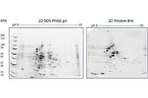 2D SDS-PAGE: Load/Strip: 100 μg E.