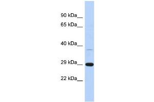 WB Suggested Anti-C1orf74 Antibody Titration: 0. (C1ORF74 anticorps  (N-Term))