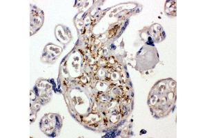 Anti-BAG5 antibody, IHC(P) IHC(P): Human Placenta Tissue