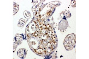 Anti-BAG5 antibody, IHC(P) IHC(P): Human Placenta Tissue (BAG5 anticorps  (C-Term))